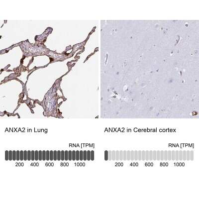 Immunohistochemistry-Paraffin: Annexin A2 Antibody [NBP2-62638]