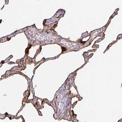 Immunohistochemistry-Paraffin: Annexin A2 Antibody [NBP2-62638]