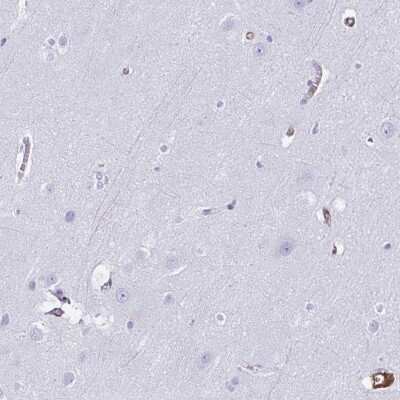 Immunohistochemistry-Paraffin: Annexin A2 Antibody [NBP2-62638]