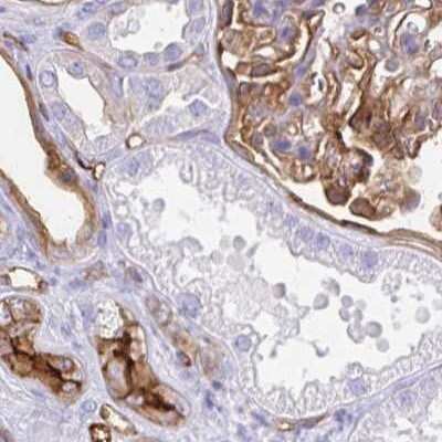 Immunohistochemistry-Paraffin: Annexin A2 Antibody [NBP2-62638]