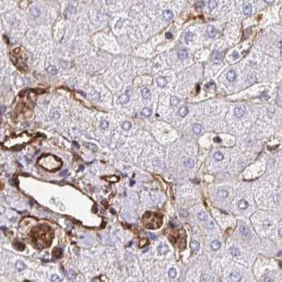 Immunohistochemistry-Paraffin: Annexin A2 Antibody [NBP2-62638]