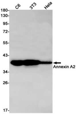 Western Blot: Annexin A2 Antibody (S09-5C1) [NBP3-14907]