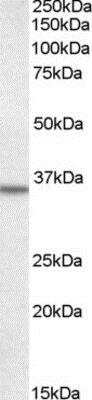 Western Blot: Annexin A2 Antibody [NB100-881]