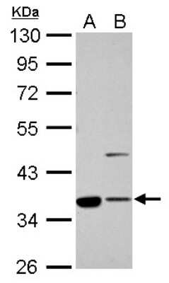 Western Blot: Annexin A2 Antibody [NBP1-31310]