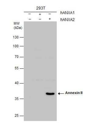 Western Blot: Annexin A2 Antibody [NBP1-31310]