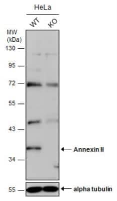 Knockout Validated: Annexin A2 Antibody [NBP1-31310]