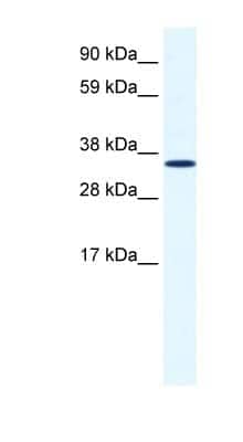 Western Blot: Annexin A2 Antibody [NBP1-59124]