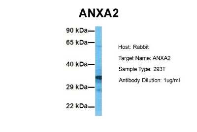Western Blot: Annexin A2 Antibody [NBP1-59124]
