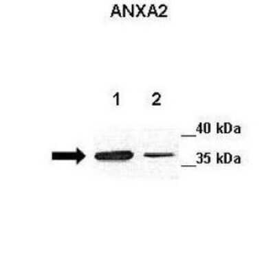 Western Blot: Annexin A2 Antibody [NBP1-59124]