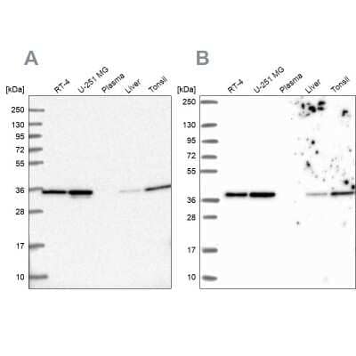 Western Blot: Annexin A2 Antibody [NBP2-62614]