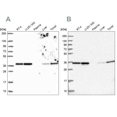 Western Blot: Annexin A2 Antibody [NBP2-62638]