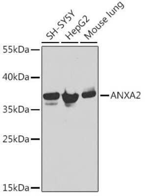 Western Blot: Annexin A2 AntibodyBSA Free [NBP2-92959]