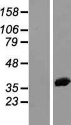 Western Blot: Annexin A2 Overexpression Lysate [NBL1-07561]