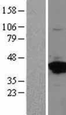 Western Blot: Annexin A2 Overexpression Lysate [NBL1-07562]