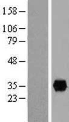 Western Blot: Annexin A4 Overexpression Lysate [NBL1-07564]