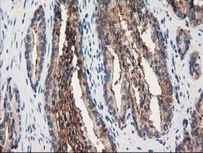 Immunohistochemistry-Paraffin: Annexin A3 Antibody (OTI1A5) [NBP2-03374]