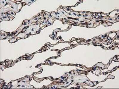 Immunohistochemistry-Paraffin: Annexin A3 Antibody (OTI1A5) [NBP2-03374]