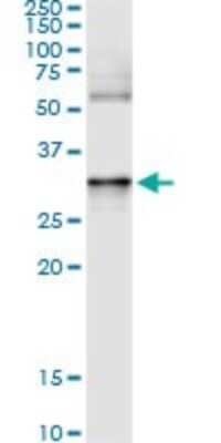 Immunoprecipitation: Annexin A3 Antibody (1E2) [H00000306-M07]