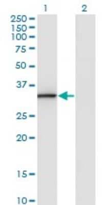 Western Blot: Annexin A3 Antibody (1E2) [H00000306-M07]