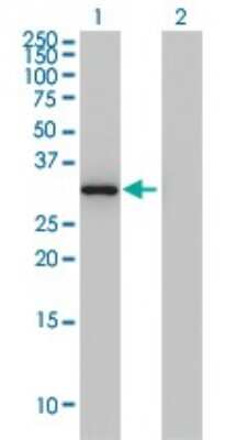 Western Blot: Annexin A3 Antibody (4F1) [H00000306-M12]