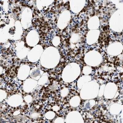 Immunohistochemistry-Paraffin: Annexin A3 Antibody [NBP1-90154]