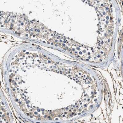 Immunohistochemistry-Paraffin: Annexin A3 Antibody [NBP1-90154]