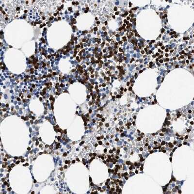 Immunohistochemistry-Paraffin: Annexin A3 Antibody [NBP1-90155]