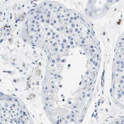 Immunohistochemistry-Paraffin: Annexin A3 Antibody [NBP1-90155]