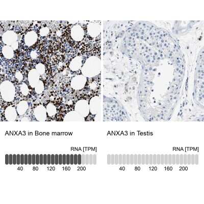 Immunohistochemistry-Paraffin: Annexin A3 Antibody [NBP1-90155]