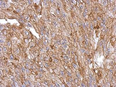 Immunohistochemistry-Paraffin: Annexin A3 Antibody [NBP2-15407]