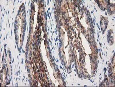 Immunohistochemistry: Annexin A3 Antibody (OTI1A5) - Azide and BSA Free [NBP2-70179]