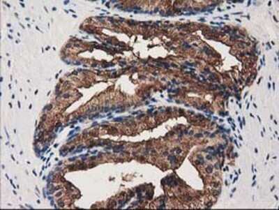 Immunohistochemistry: Annexin A3 Antibody (OTI1A5) - Azide and BSA Free [NBP2-70179]