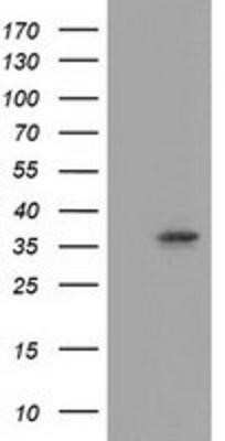 Western Blot: Annexin A3 Antibody (OTI1A5)Azide and BSA Free [NBP2-70179]