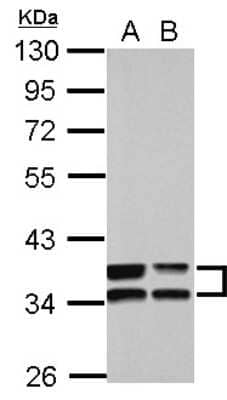 Western Blot: Annexin A3 Antibody [NBP2-15407]