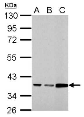 Western Blot: Annexin A3 Antibody [NBP2-15408]