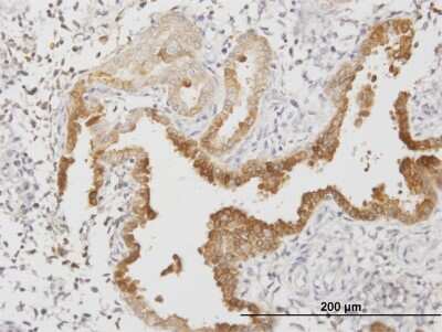 Immunohistochemistry-Paraffin: Annexin A4 Antibody (1D3) [H00000307-M13]