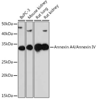 Western Blot: Annexin A4 Antibody (8T6E6) [NBP3-16785]