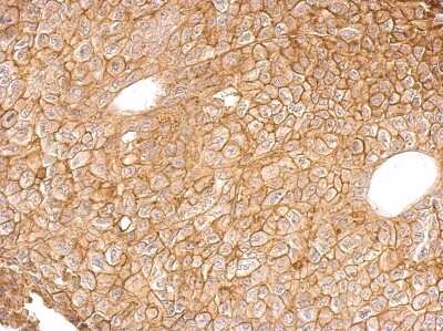 Immunohistochemistry-Paraffin: Annexin A4 Antibody [NBP1-31751]