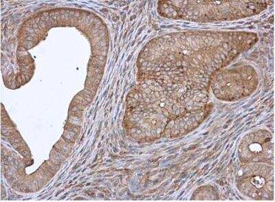 Immunohistochemistry-Paraffin: Annexin A4 Antibody [NBP1-31751]