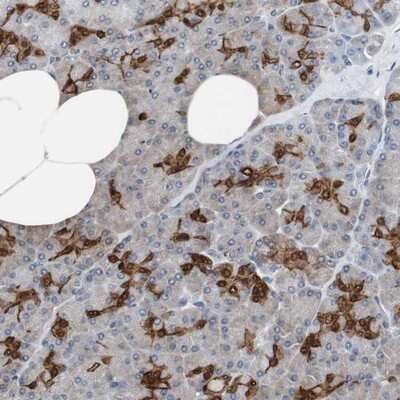 Immunohistochemistry-Paraffin: Annexin A4 Antibody [NBP1-90151]