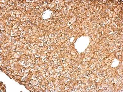 Immunohistochemistry-Paraffin: Annexin A4 Antibody [NBP2-15409]