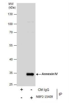 Immunoprecipitation: Annexin A4 Antibody [NBP2-15409]