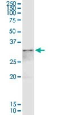 Western Blot: Annexin A4 Antibody [H00000307-D01P]