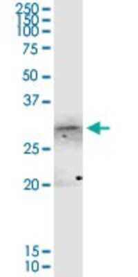 Western Blot: Annexin A4 Antibody [H00000307-D01P]