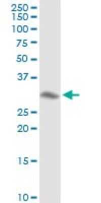 Western Blot: Annexin A4 Antibody [H00000307-D01P]