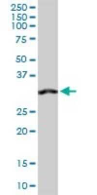 Western Blot: Annexin A4 Antibody [H00000307-D01P]
