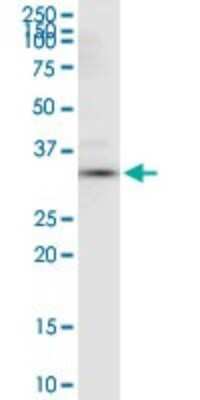 Western Blot: Annexin A4 Antibody [H00000307-D01P]