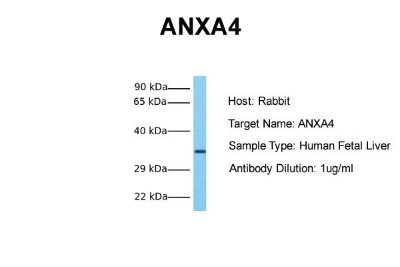 Western Blot: Annexin A4 Antibody [NBP1-59120]