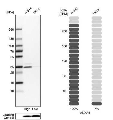 Western Blot: Annexin A4 Antibody [NBP1-90151]