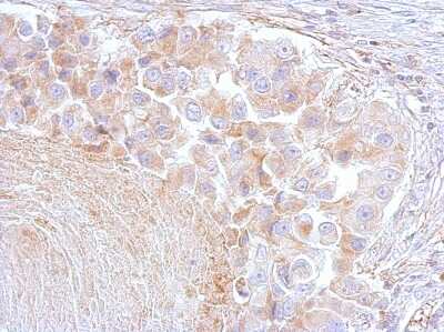 Immunohistochemistry-Paraffin: Annexin A6 Antibody [NBP1-32091]